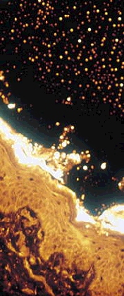 rhodamine skin compressed rhodamine skin compressed